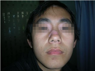 快来看下，白癜风对患者四大影响?(图1)