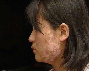 白癜风患者引发白癜风疾病有哪些?(图1)